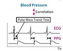 A diagram of a pulse

AI-generated content may be incorrect.