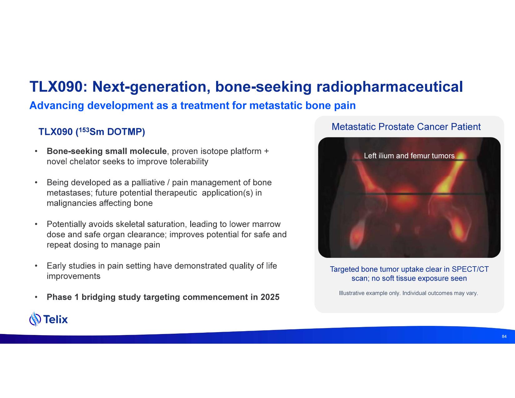 investdayprez.pdf page 86